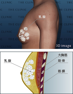 真性女性化乳房 状態図