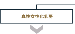 真性女性化乳房